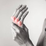 Arthritis Orthopedics Treatment NYC