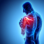 shoulder pain