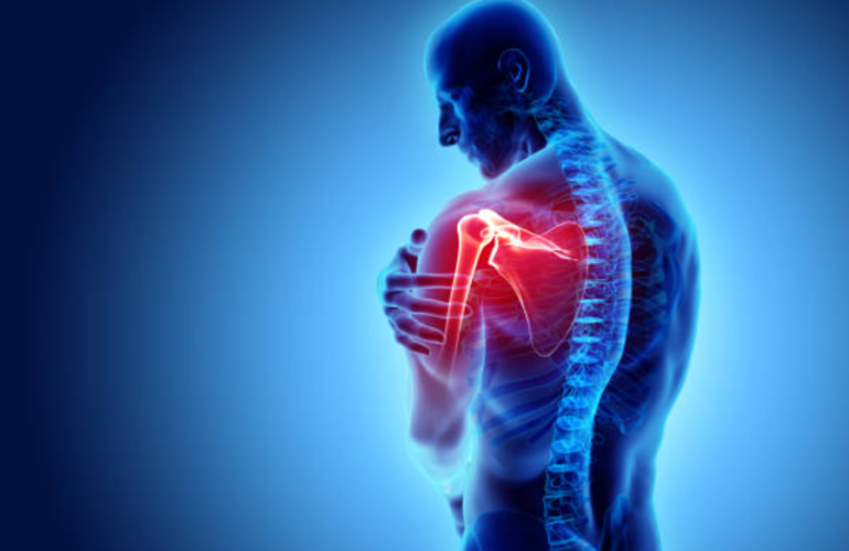 shoulder pain