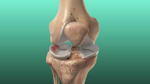 orthopedic specialist for knee in Englewood