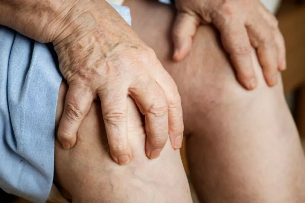 arthritis specialist in Clifton, NJ