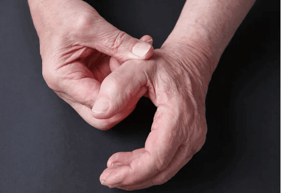 How Hand Arthritis Is Diagnosed