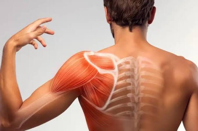 Discover shoulder bursitis causes, symptoms, and treatment options in Queens, including home care and surgery with Dr. Sean Thompson.